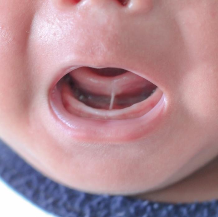 Close up of child opening their mouth wide