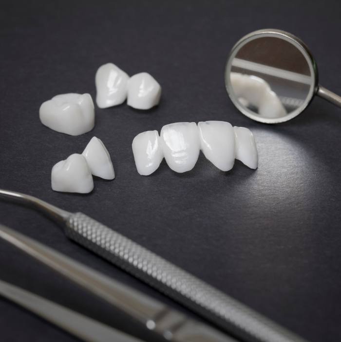 Several metal free dental crowns and veneers on table with dental instruments