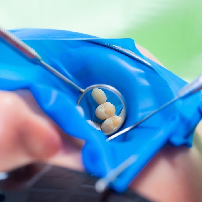 Close up of dental mirror reflecting a row of natural looking teeth