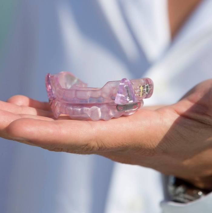 Dentist holding light purple oral appliance for sleep apnea treatment