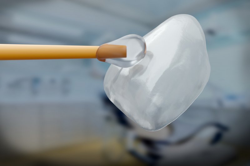 A 3D illustration of a porcelain veneer and applicator